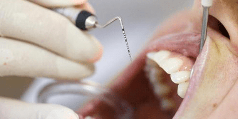 Dental Exam for Periodontal Disease